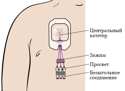 Интернет-магазин, который не придётся переделывать через полгода: простым языком